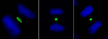 Rabbit PLK1 Antibody