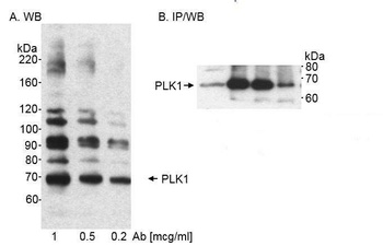 Rabbit PLK1 Antibody