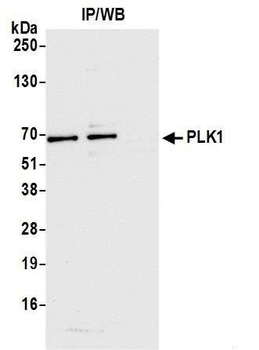Rabbit PLK1 Antibody