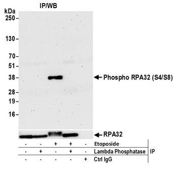 RPA32, Phospho (S4/S8) Antibody
