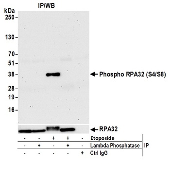 Rabbit anti-Phospho RPA32 (S4/S8) Antibody