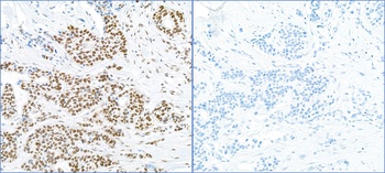 RPA32, Phospho (S4/S8) Antibody