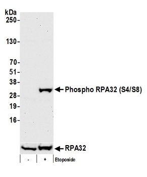 Rabbit anti-Phospho RPA32 (S4/S8) Antibody