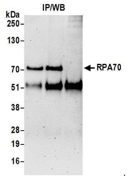 RPA70 Antibody