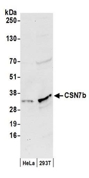 Rabbit CSN7b Antibody