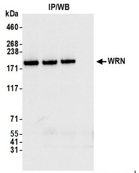 WRN Antibody