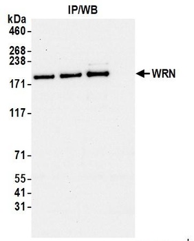 WRN Antibody