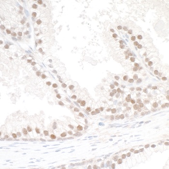 Rabbit anti-SMC6 Antibody