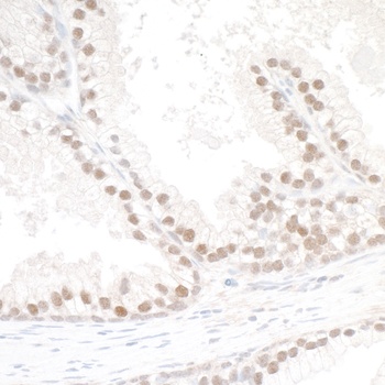 SMC6 Antibody