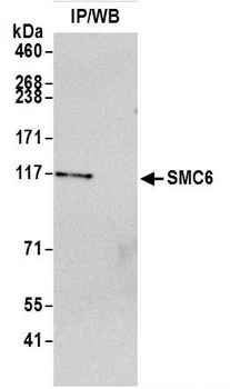 Rabbit anti-SMC6 Antibody