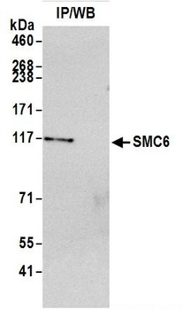 SMC6 Antibody