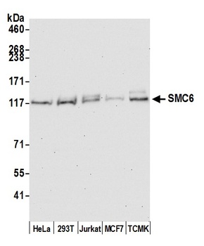 Rabbit anti-SMC6 Antibody