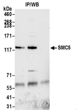 Rabbit anti-SMC5 Antibody