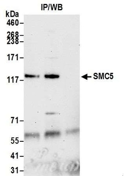 SMC5 Antibody