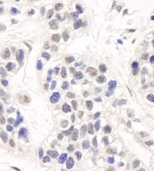 Rabbit anti-Artemis Antibody