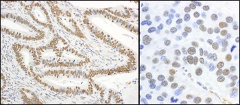 Rabbit anti-Phospho XRCC1 (S485/T488) Antibody