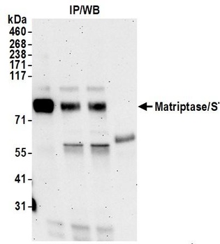 Matriptase/ST14 Antibody