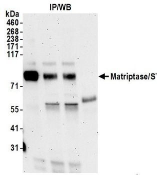 Rabbit Matriptase/ST14 Antibody