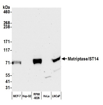 Rabbit Matriptase/ST14 Antibody