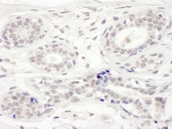 Rabbit anti-BRD8 Antibody