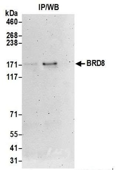 Rabbit anti-BRD8 Antibody