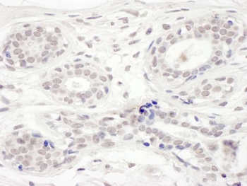 BRD8 Antibody