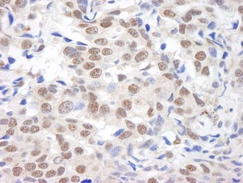 Rabbit BHC110/LSD1 Antibody