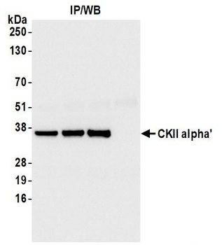 CKII alpha Antibody