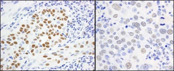 Rabbit anti-MCM5 Antibody
