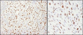 Rabbit MCM4 Antibody