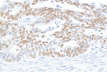 MCM2 Antibody