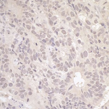 Rabbit anti-RFC3 Antibody