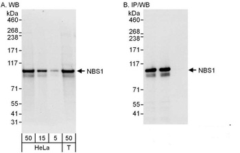 Rabbit NBS1 Antibody