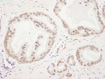 Rabbit anti-Rad50 Antibody