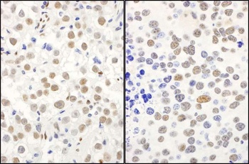 Rabbit anti-QKI Antibody