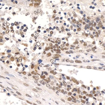 Rabbit Paf1 Antibody