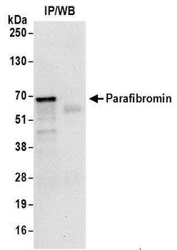 Parafibromin Antibody