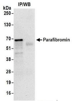 Rabbit Parafibromin Antibody