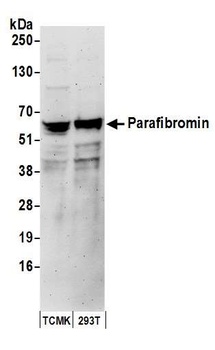 Rabbit Parafibromin Antibody