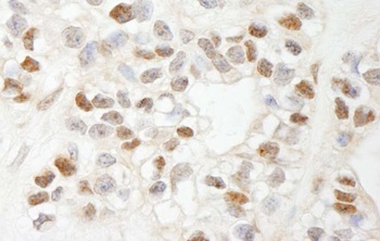 Rabbit anti-MCAF Antibody