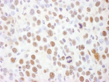 Rabbit anti-Phospho Rad17 (S645) Antibody