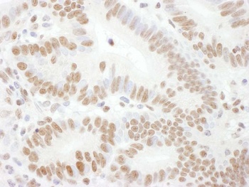 Rabbit anti-Phospho Rad17 (S645) Antibody