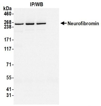 NF1 Antibody