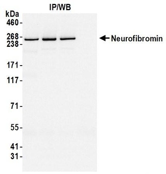 Rabbit NF1 Antibody