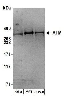 Goat ATM Antibody