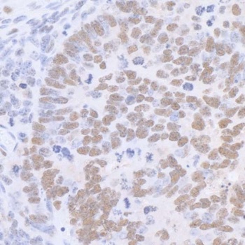 Rabbit anti-Sp1 Antibody