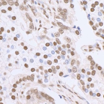 Rabbit anti-Sp1 Antibody