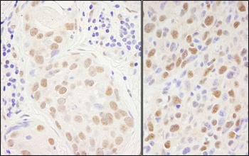 Rabbit Sp1 Antibody