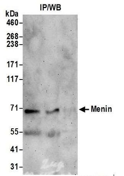 Rabbit anti-Menin Antibody