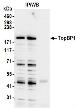 TopBP1 Antibody